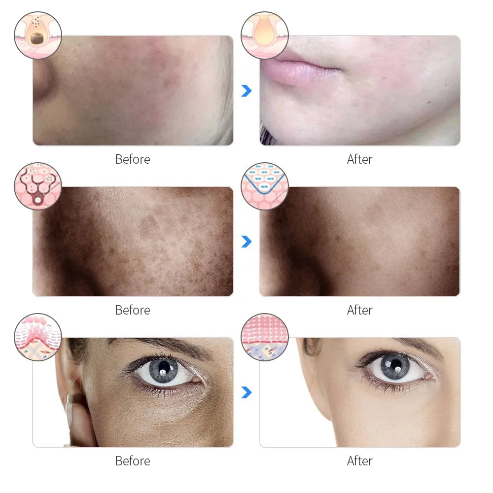 LED Masker | 7 kleuren LED lichttherapie masker | Huidverzorging | Huidverjongingsapparaat | Veilig voor alle huidtypes