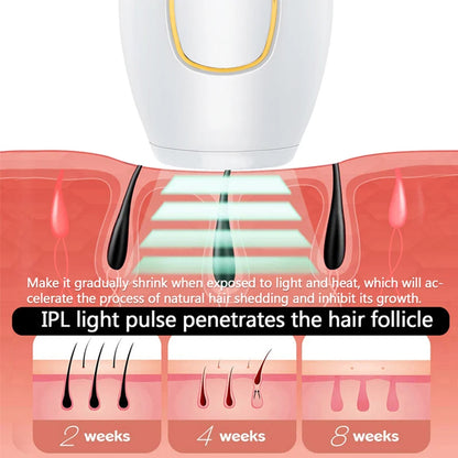 Professionele permanente laser-epilator IPL ontharingshandset thuisgebruik voor dames en heren